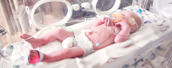 Baby lying in incubator